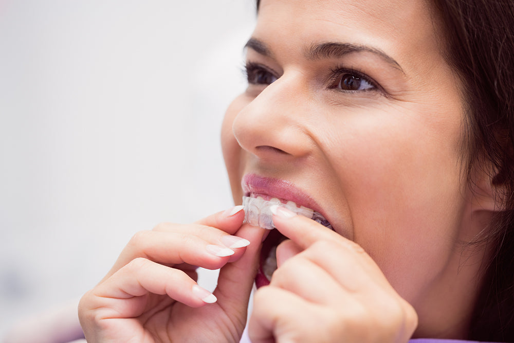 Kobieta ściąga nakładki Invisalign. Jak dbać o higienę jamy ustnej z nakładkami?
